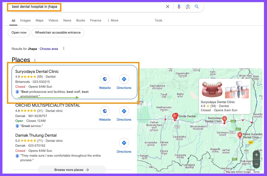 suryodaya dental clinic jhapa-Local SEO for Dentists in Nepal- Importance -best dental hospitals in jhapa-kumarpradhan.com